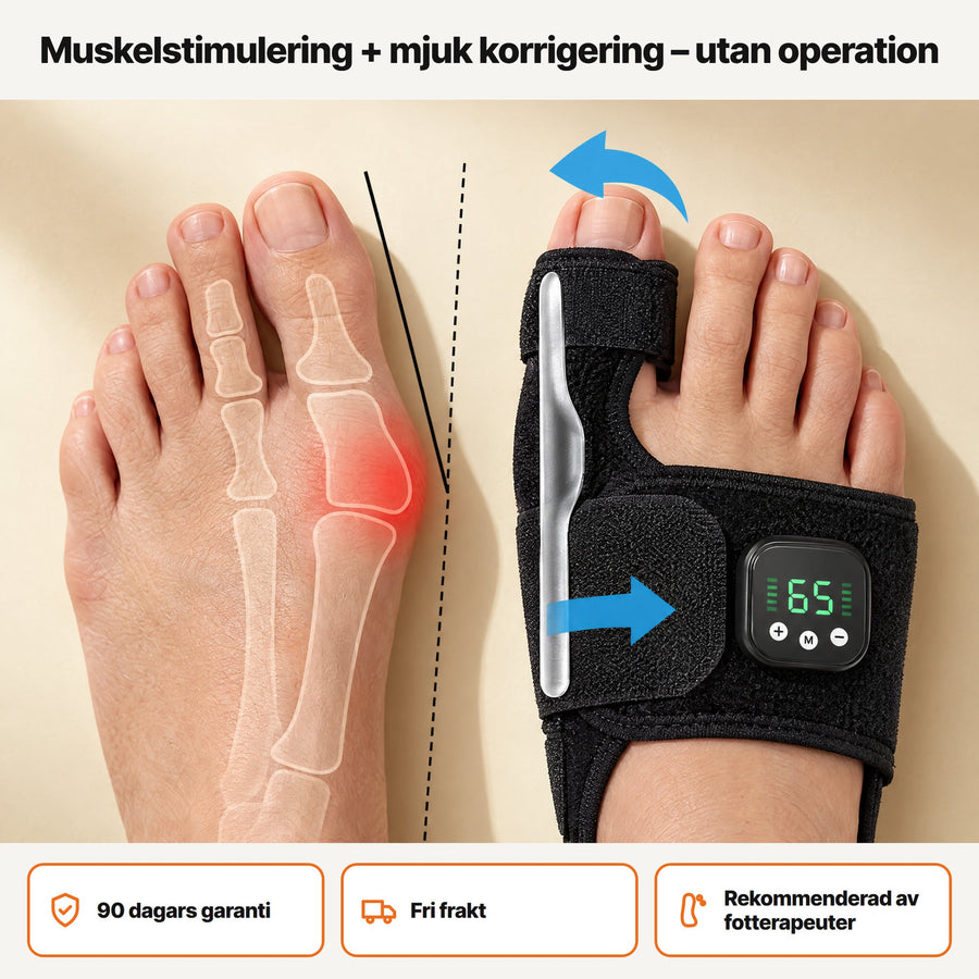 Stryde Bunion EMS, hallux valgus-korrigerare med muskelstimulering