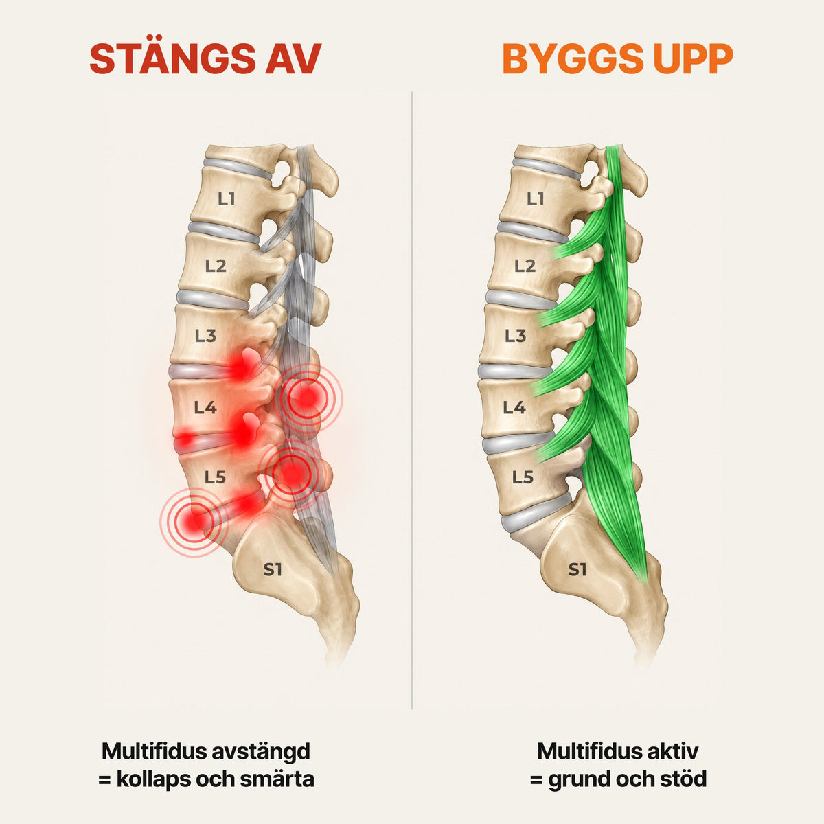 Stryde Core Pro, adaptivt NMES-system för ryggen – multifidus