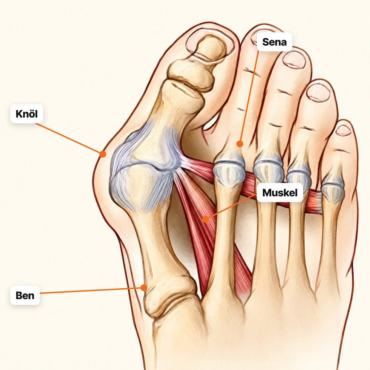 Stryde Bunion EMS, hallux valgus-korrigerare med muskelstimulering