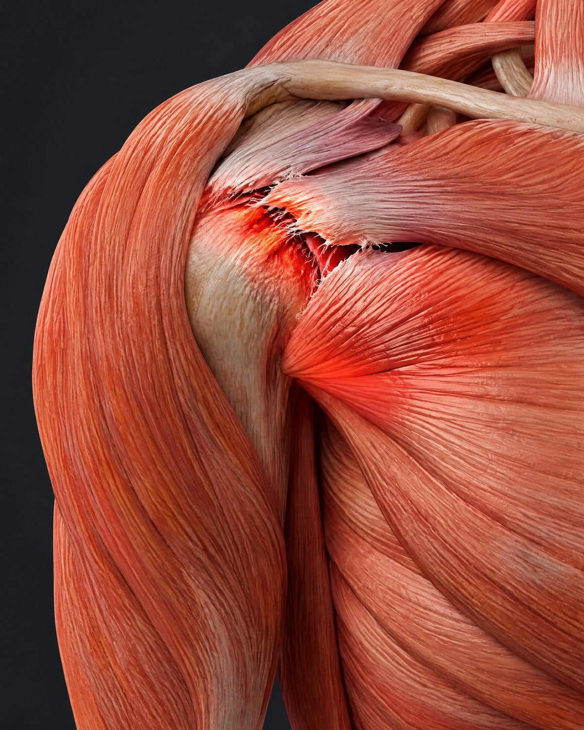 Stryde Shoulder Pro, trippelterapi för axeln